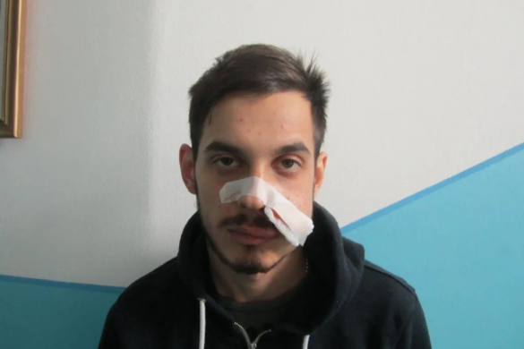 Timișorean ÎMPUȘCAT în față, la Oravița. De ce spun polițiștii că l-au lăsat liber pe ”pistolar” FOTO