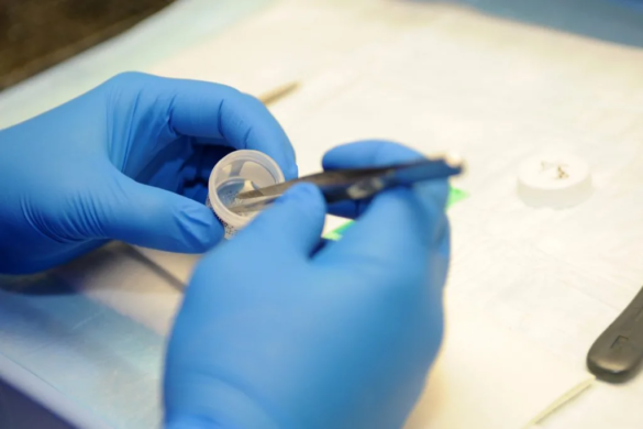 Medicii de la Chirurgie Cardiovasculară povestesc ororile din spital. Reacţia Ministerului Sănătăţii