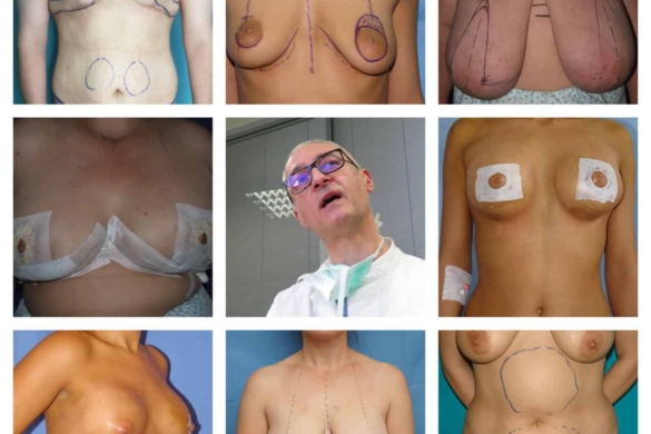 Adevăr sau minciună? Prof. dr. Mihai Ionac își cartografia pacienții de chirurgie vasculară după tehnici de intervenție plastică și reparatorie