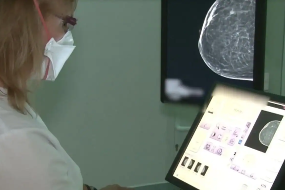 Cancerul la sân, depistat cu 2 ani înainte de a putea fi descoperit prin palpare, cu ajutorul unui aparat performant, la Spitalul Victor Babeş din Timişoara!