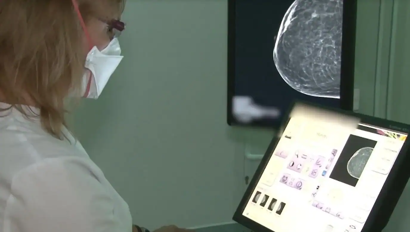 Cancerul la sân, depistat cu 2 ani înainte de a putea fi descoperit prin palpare, cu ajutorul unui aparat performant, la Spitalul Victor Babeş din Timişoara!