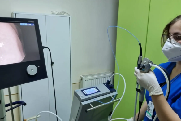 Procedură unică în vestul țării pentru diagnosticarea cancerului de plămân! Medicii timişoreni folosesc criobiopsia!